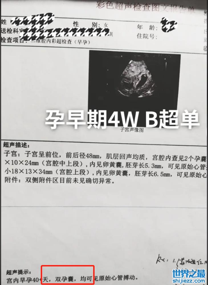 大衣哥新儿媳怀双胞胎！和老公牵手亲密接吻，给父母买豪华养老房 ... 