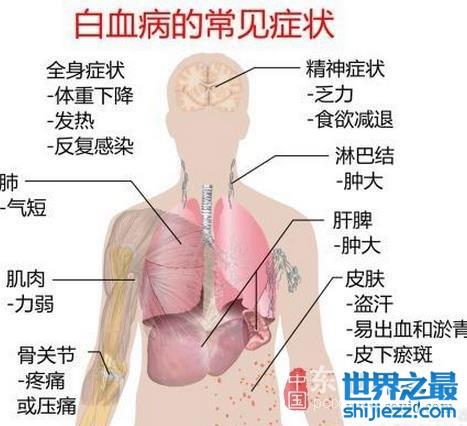 盘点世界五大绝症，如不解决恐毁灭人类 