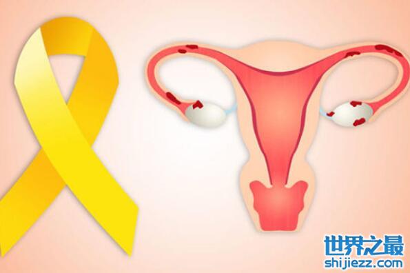 女性常见十大癌症，乳腺癌高居榜首 