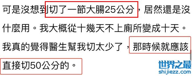 切胃、剪肠齐上阵，这些明星却越来越发福、脸垮、变样，白费劲了 ... 