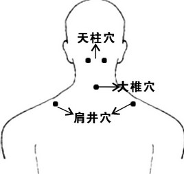 大椎穴位位置图 疏通督脉经络调畅气血