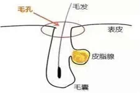 毛孔粗大如何清洁 改善肤质必备的几个护肤小知识