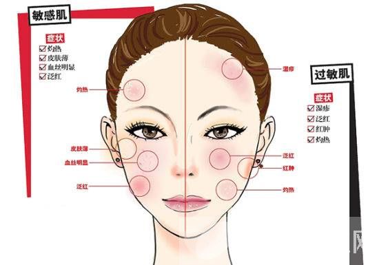 脸部换季过敏怎么办 几招帮你搞定