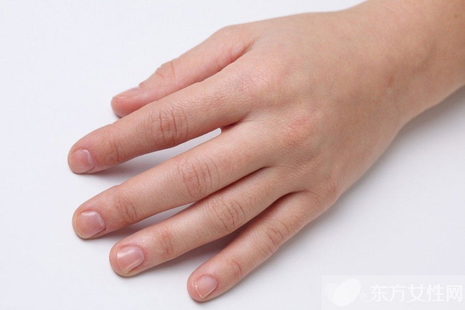 手指甲凹陷是怎么回事 当心是这些疾病所致